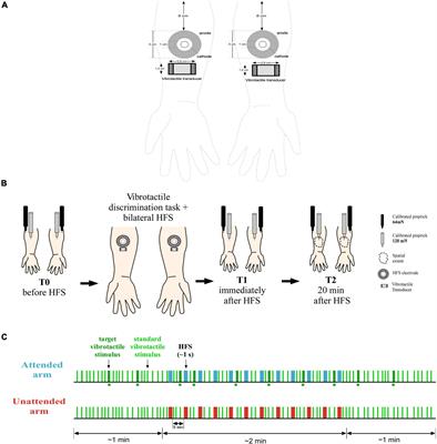 No evidence for an effect of selective spatial attention on the development of secondary hyperalgesia: A replication study